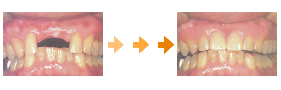 �X�}�[�g�f���`���[�r�t�H�[�A�t�^�[