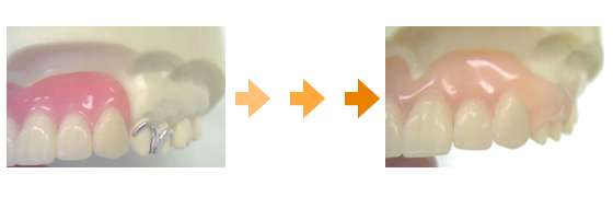 �X�}�[�g�f���`���[�r�t�H�[�A�t�^�[